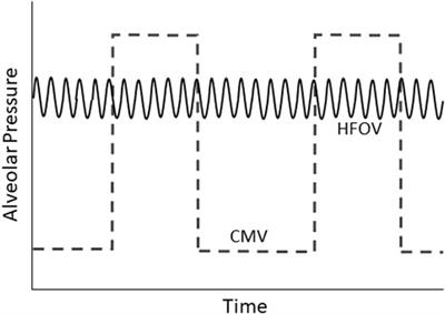 The Physiological Basis of High-Frequency Oscillatory Ventilation and Current Evidence in Adults and Children: A Narrative Review